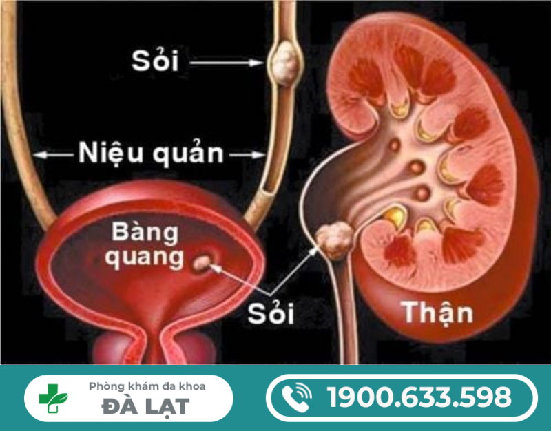 Hình ảnh minh họa